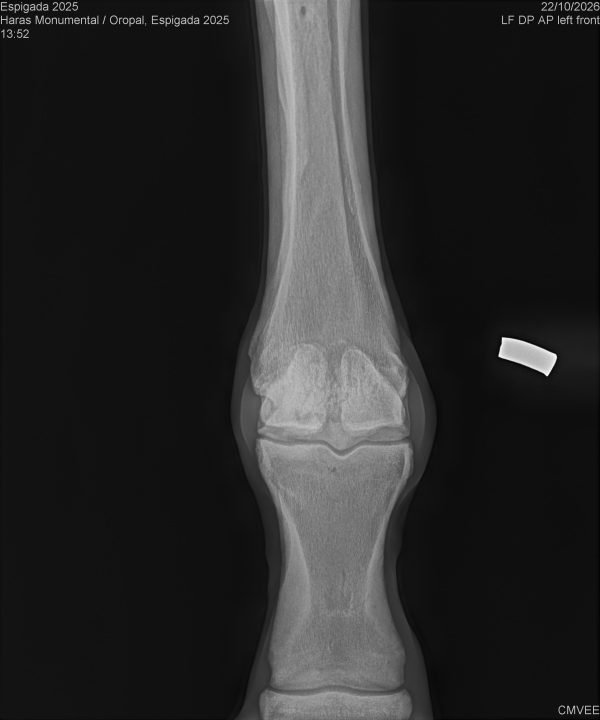 Radiografía del lote 124